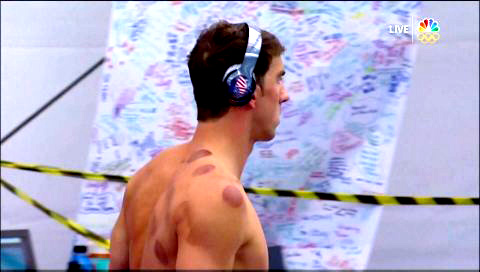 michael-phelps-cupping
