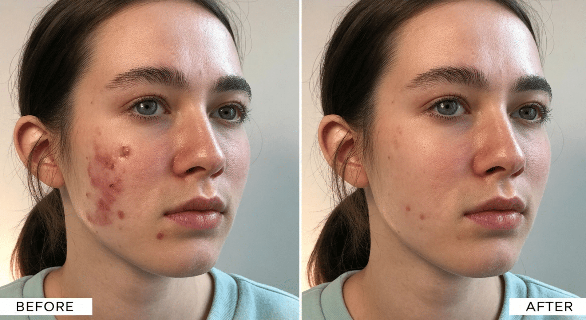 Uses of High-Frequency Facial