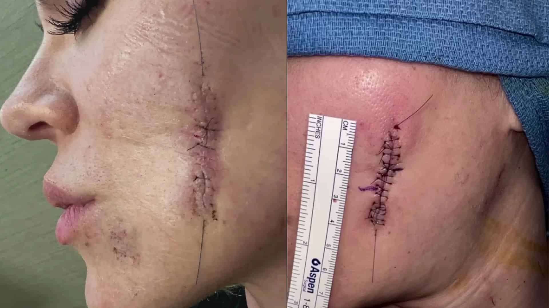 khloe kardashian face tumor