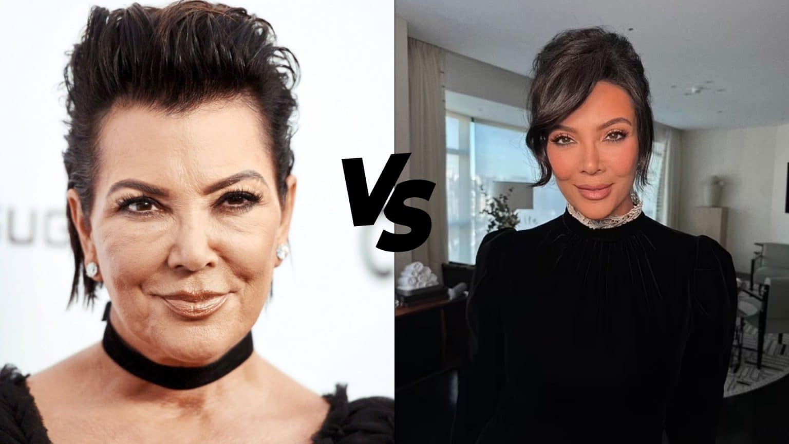kris jenner before and after face lift