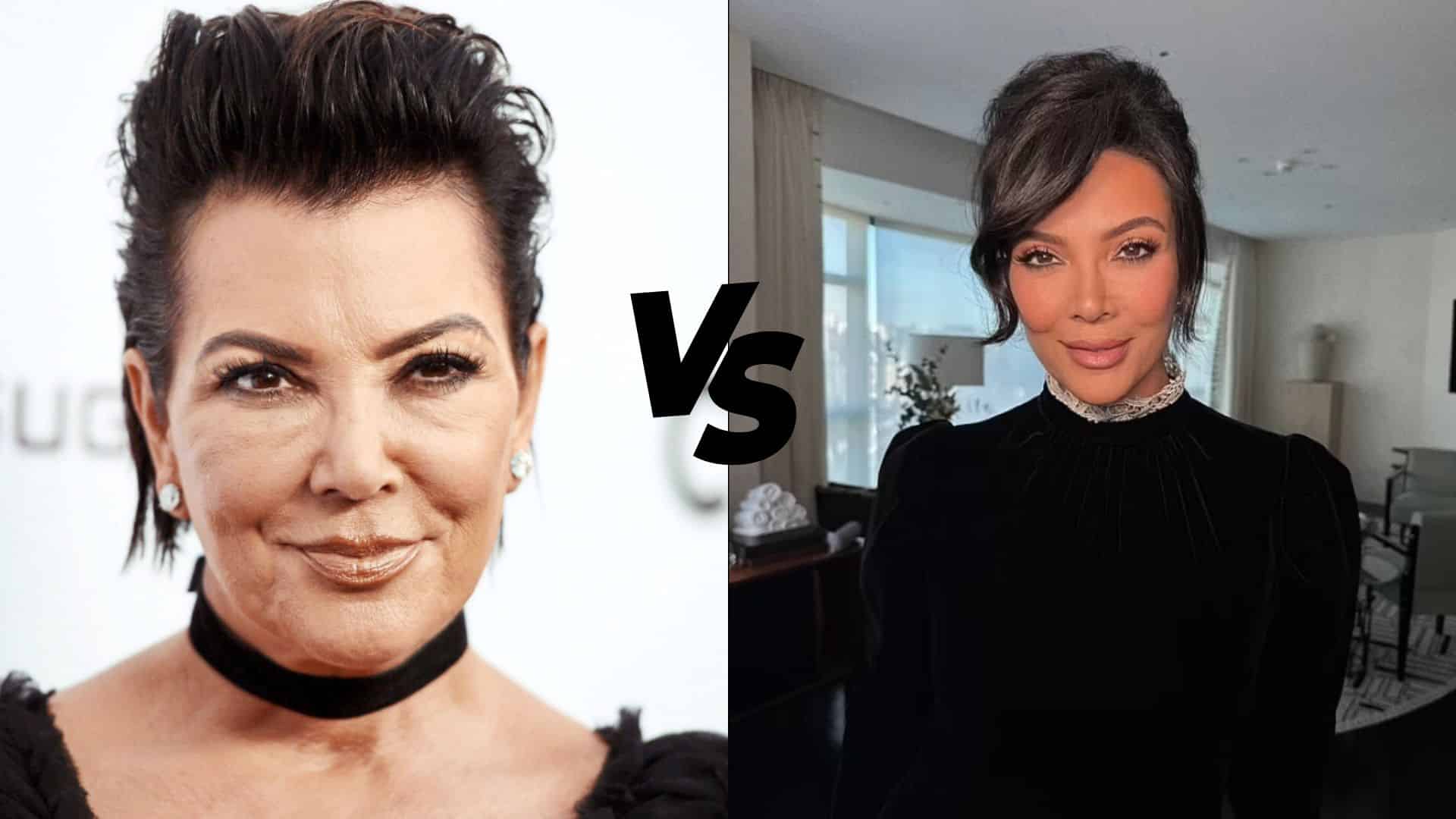 kris jenner before and after