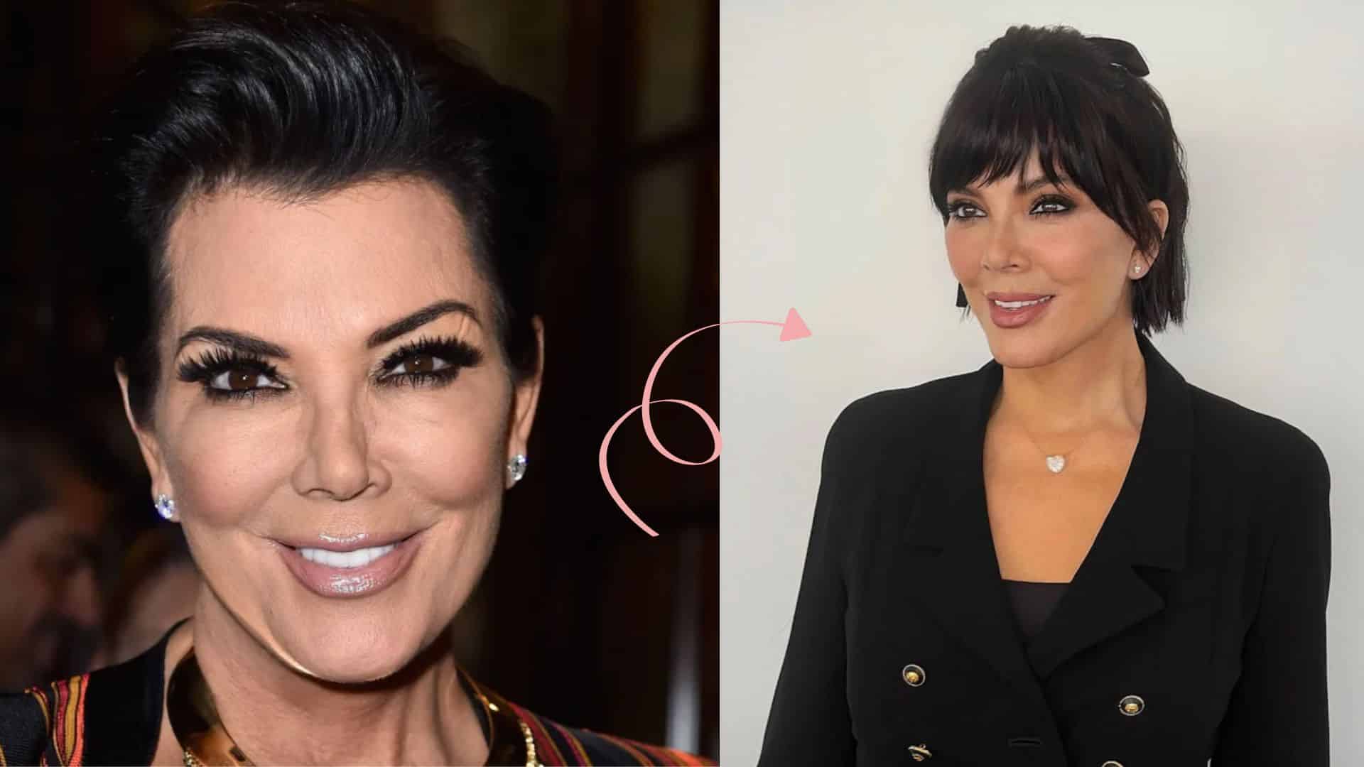 kris jenner face lift