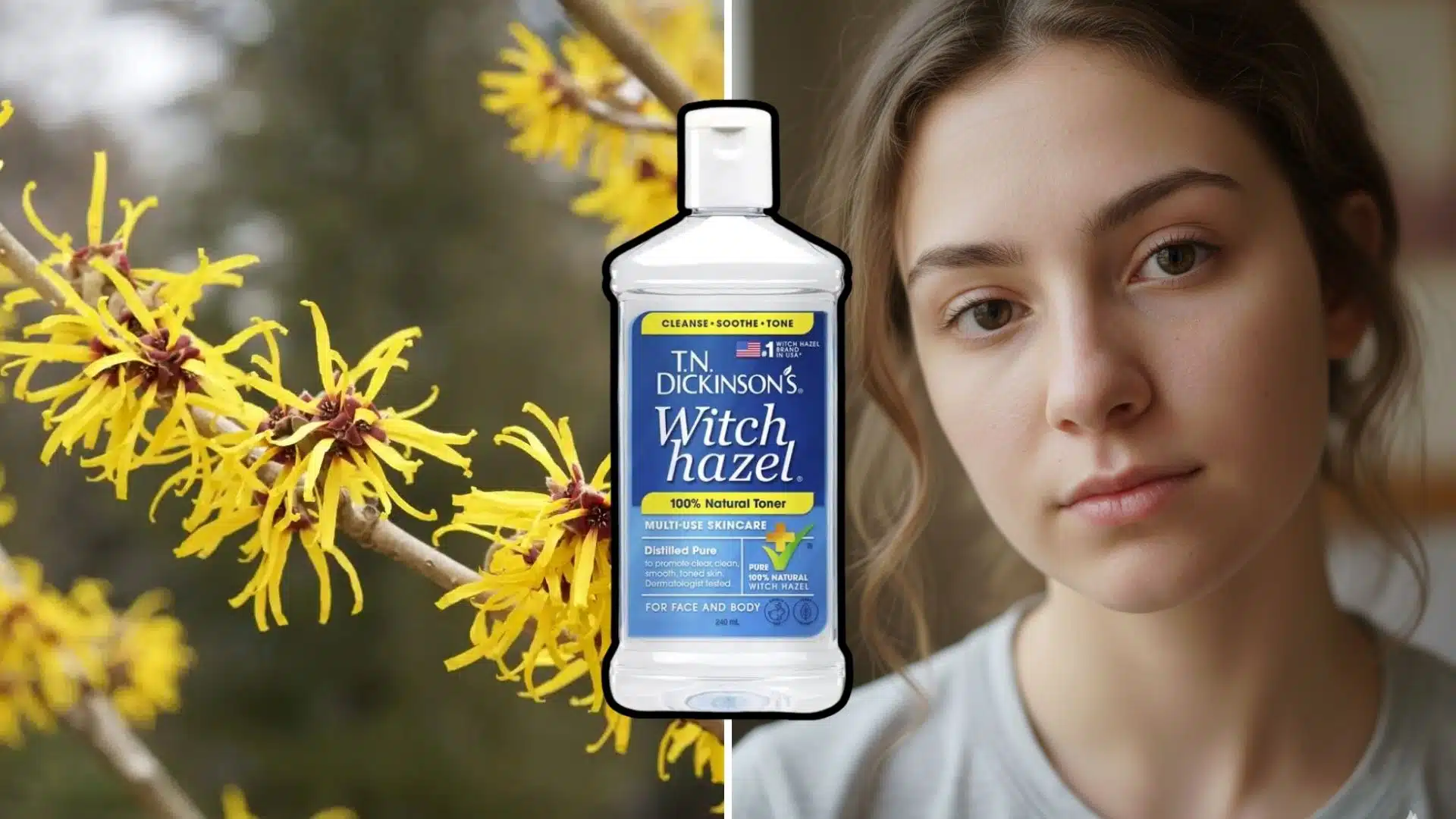 what does witch hazel do for your face