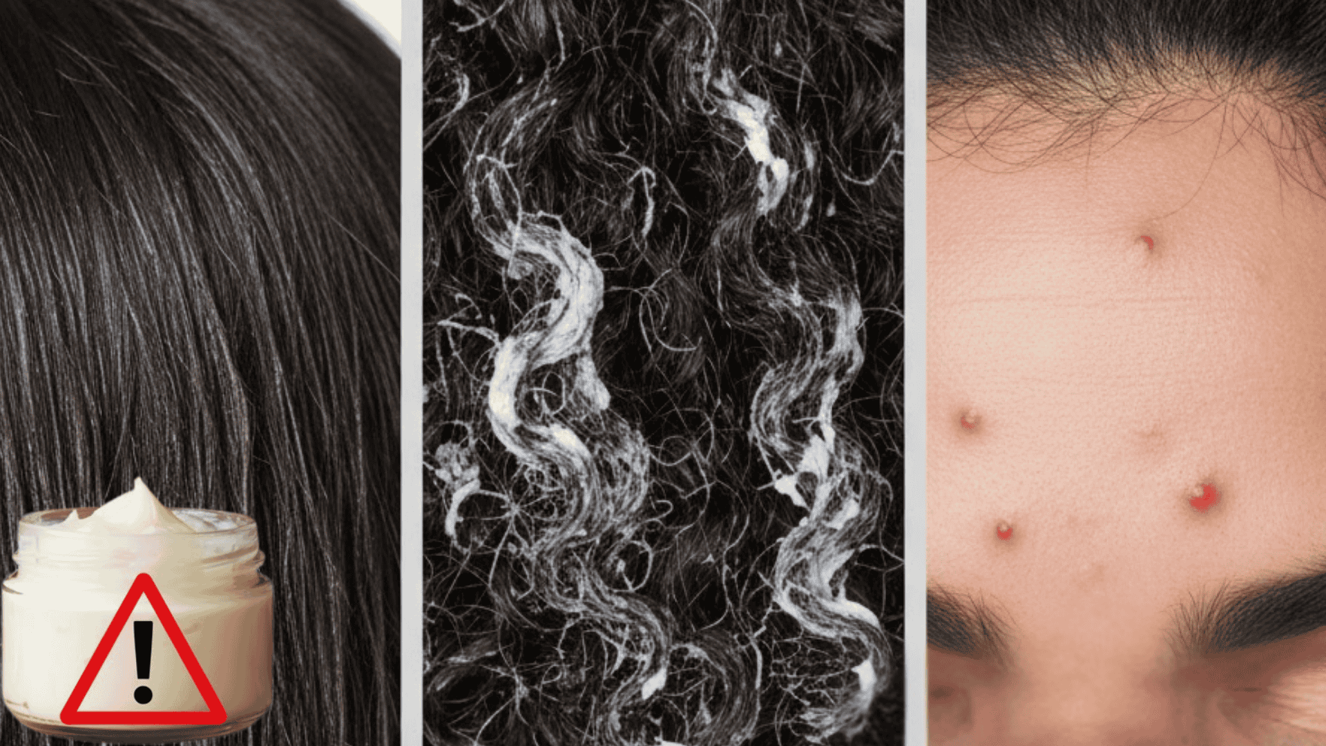 Potential Drawbacks of Shea Butter