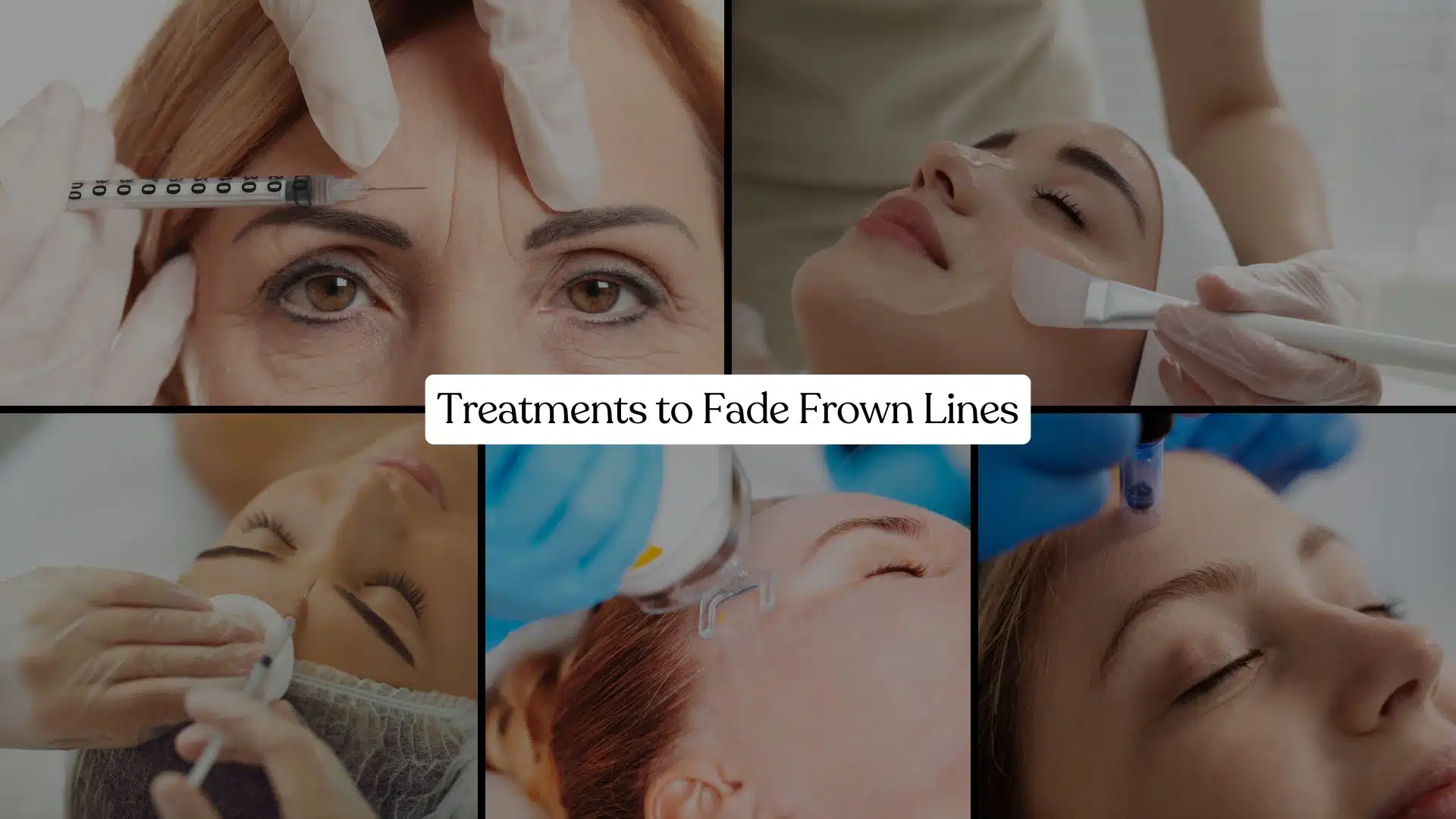 treatment frown lines