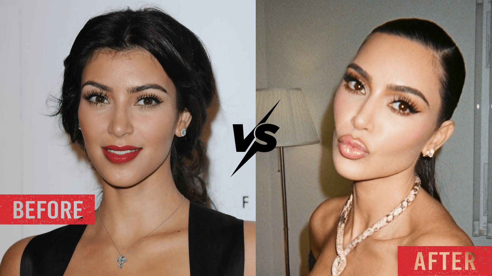 Side-by-side before-and-after comparison of Kim Kardashian, focusing on lip volume, showing thinner lips with softer definition on the left and fuller, more defined lips on the right.