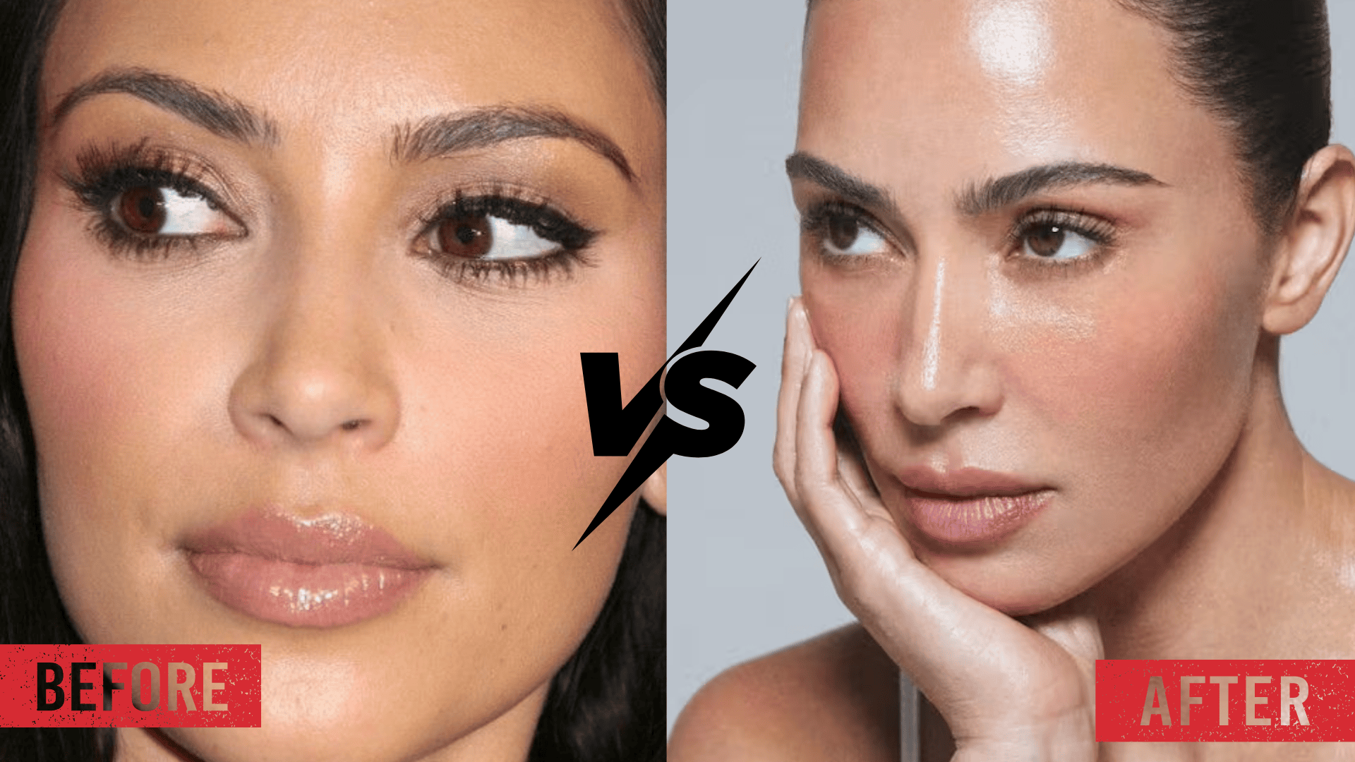 Side-by-side close-up comparison labeled before and after, focusing on Kim Kardashian’s nose shape with a fuller bridge on the left and a narrower, more defined bridge on the right