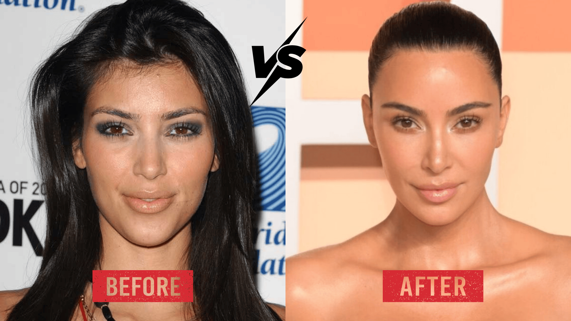 Side-by-side comparison of Kim Kardashian, focusing on skin and aging, showing a softer makeup look in earlier years and a smoother, more polished complexion in recent photos.